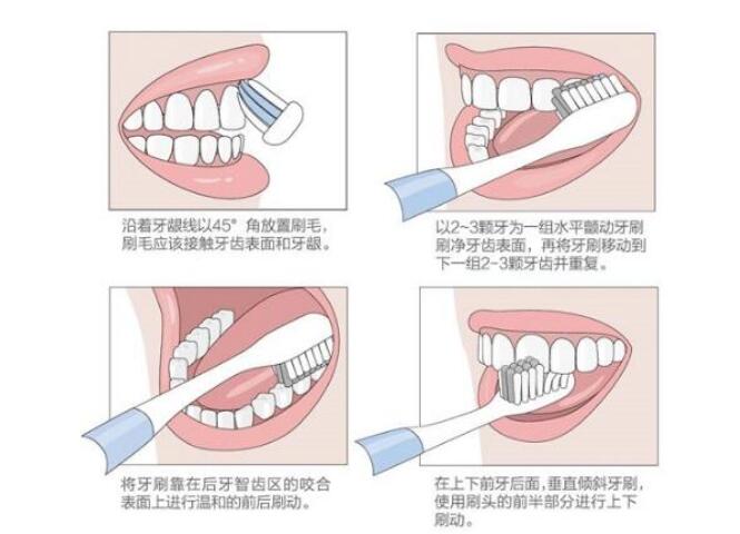 兒童的刷牙正確方法：使用巴氏刷牙法的具體操作流程